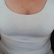 Annetje