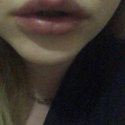 CandiceHogan