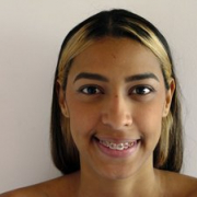 fleur-beatriz