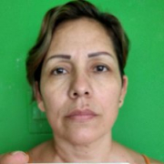 rubiperverte